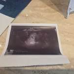 초음파 5주